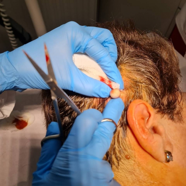 Medicus Skinzone 